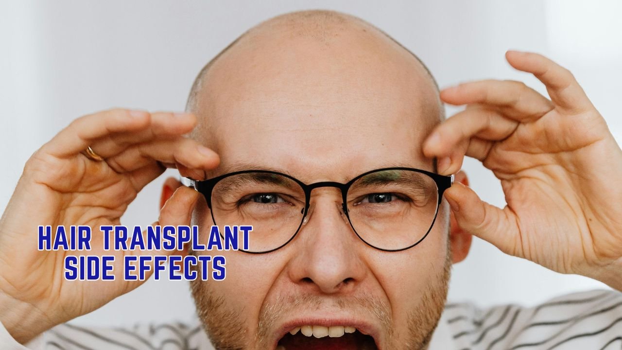 Side Effects of Hair Transplant