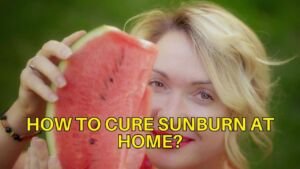 how to cure sunburn at home